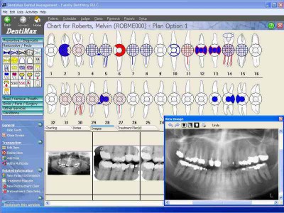 DentiMax Dental Software 06.03 screenshot