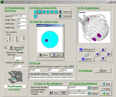 PixelProstate 2.0 screenshot