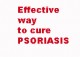 Treatment of psoriasis 2.0