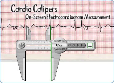 Cardio Calipers 3.3 screenshot